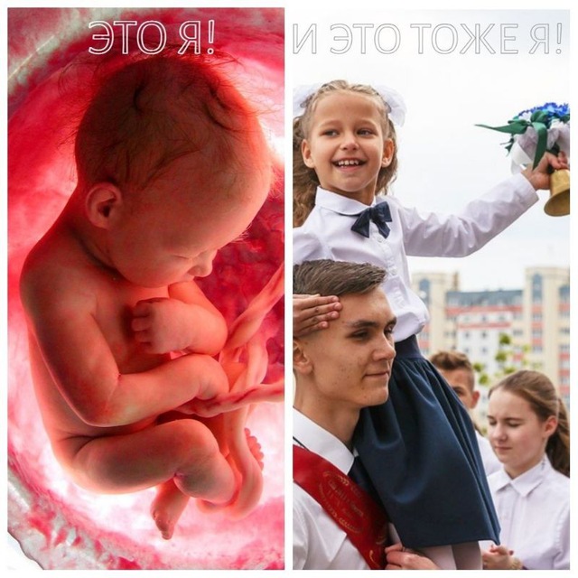 Аватар канала За жизнь! За право на жизнь с момента зачатия!