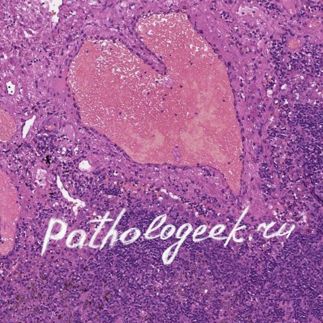 Аватар канала Pathologeek